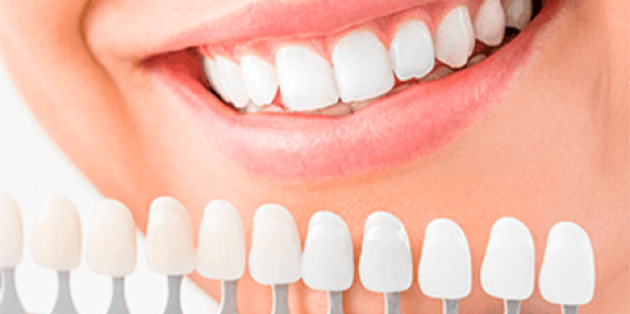Dentística – Lentes de Contato Dental